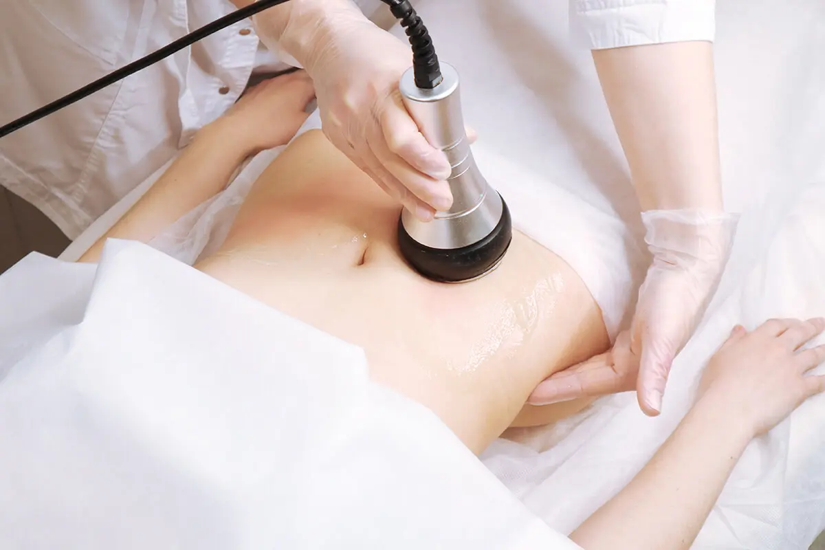 Common Misconceptions about Ultrasonic Cavitation 1