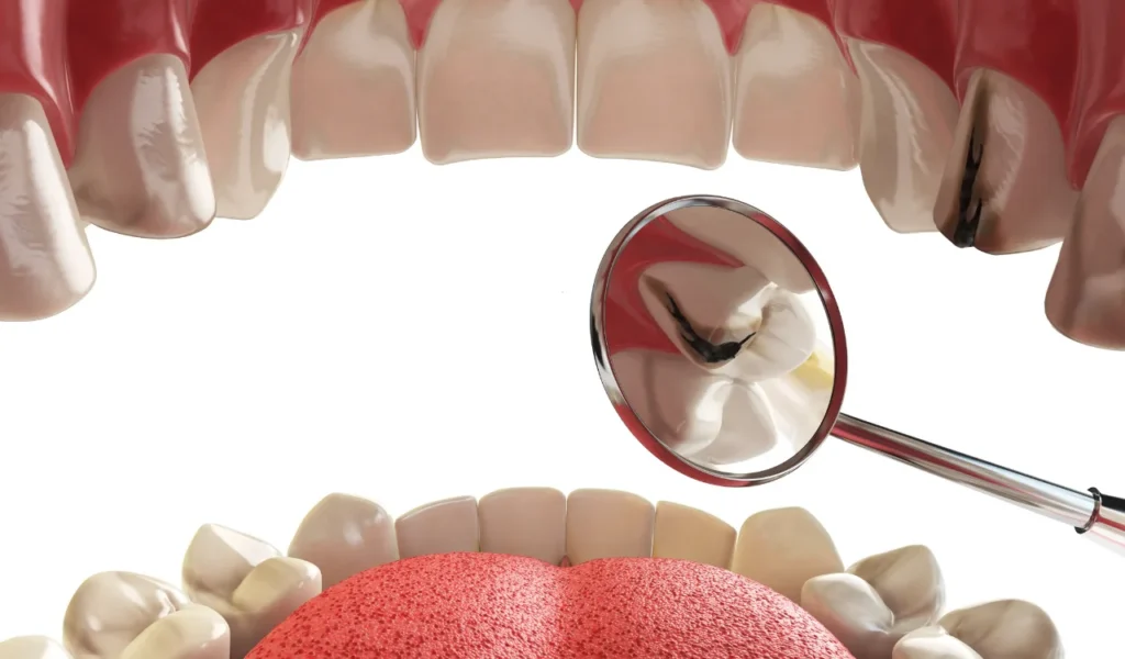 Understanding Dental Crown Pain and Its Patterns