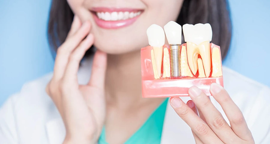 Are You Showing These 8 signs that you need dental implants?