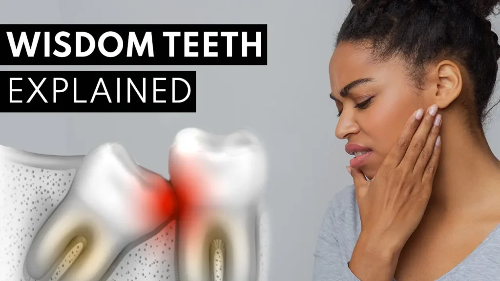 Pineapple Juice Wisdom Teeth Hack – Does It Work? 3 Whats Really Going On After Wisdom Teeth Removal