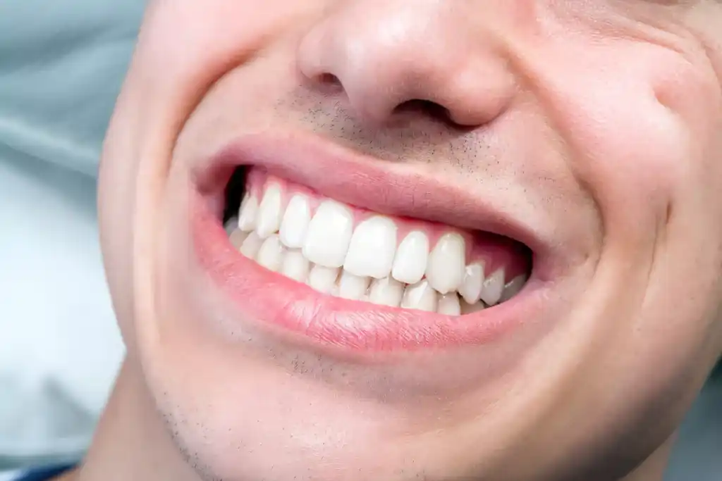 How Much Does It Cost to Remove Wisdom Teeth? 12+ Key Facts 7 Factors That Can Affect the Final Cost