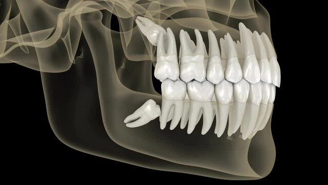 Understanding Wisdom Teeth and Their Function