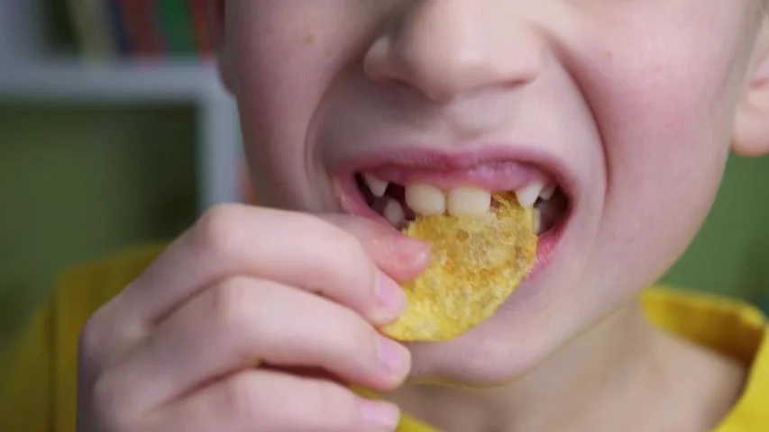 Why Chips Are a Problem After Wisdom Teeth Removal