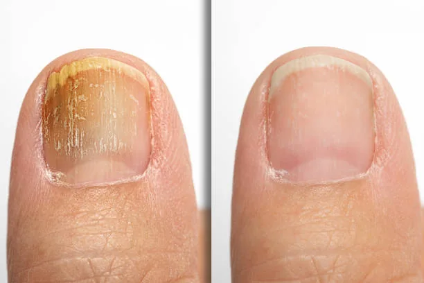 Before After Realistic