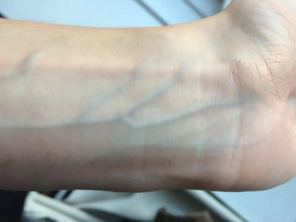 Skin Undertone Blue vs Green Veins on Wrist: Identify Yours 5 Blue Veins on Wrist — What It Means