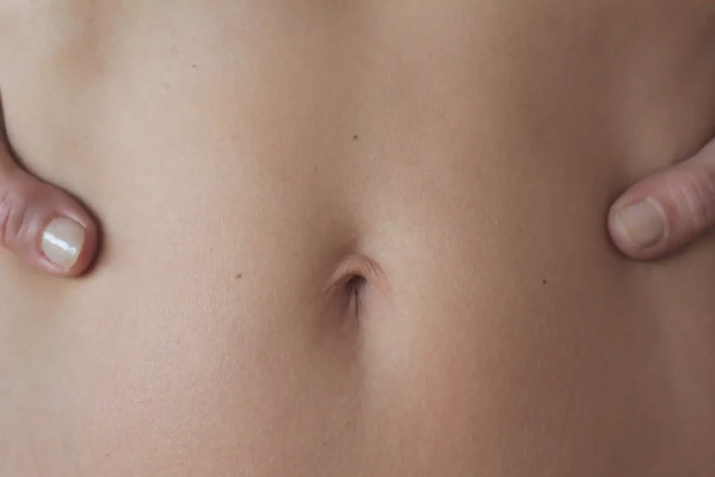 Common Causes of Belly Button Infections