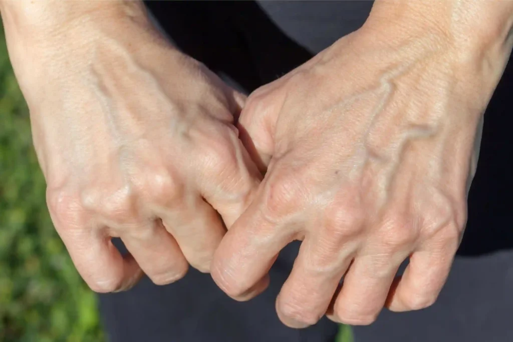 Skin Undertone Blue vs Green Veins on Wrist: Identify Yours 6 Green Veins on Wrist — What It Means