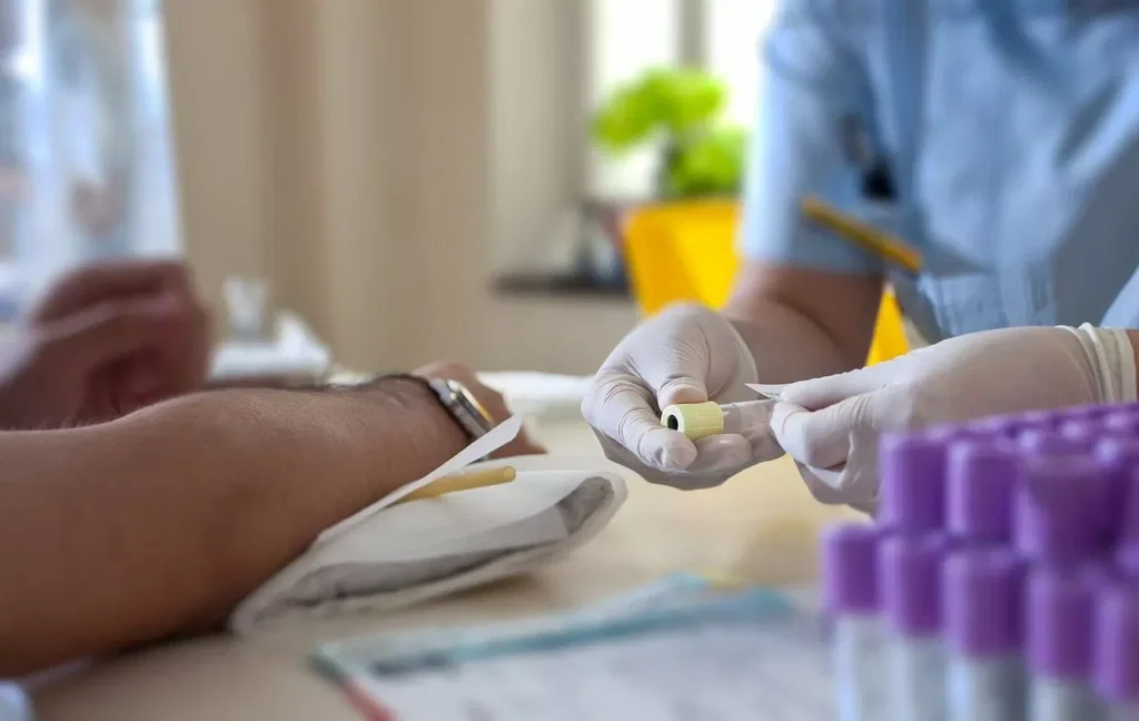 How to Prepare for a Blood Test Measuring MPV