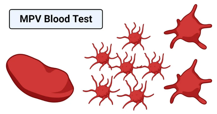 MPV and Platelet Count Understanding the Connection
