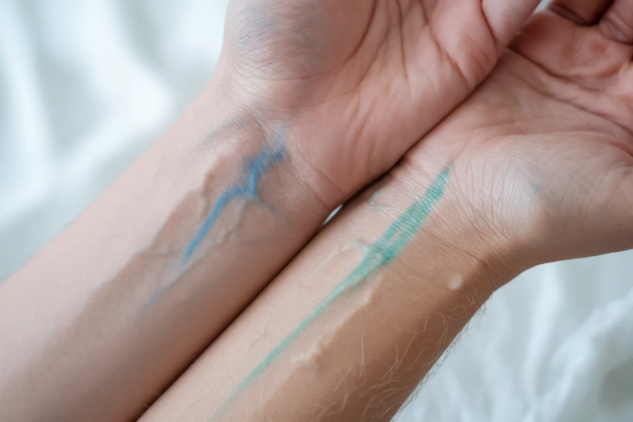 Skin Undertone Blue vs Green Veins on Wrist Identify Yours