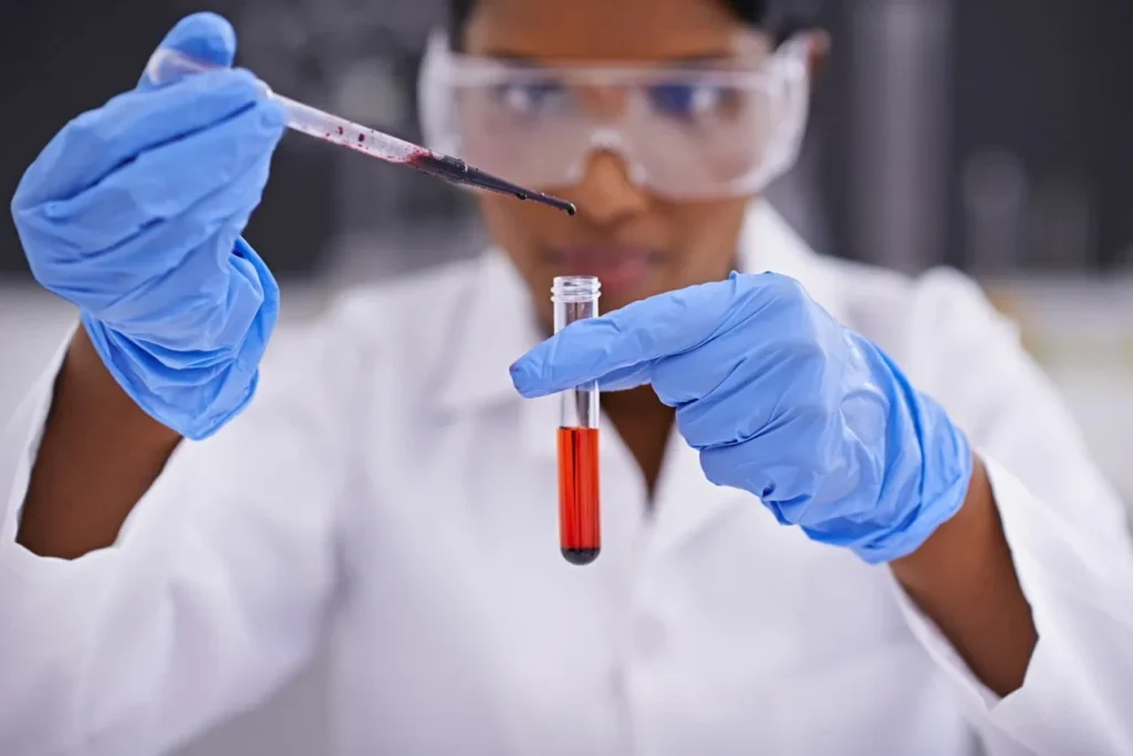 What Is MPV in a Blood Test