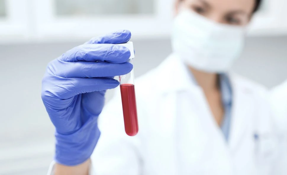 What Is MPV in a Blood Test Causes, Normal Range & Results