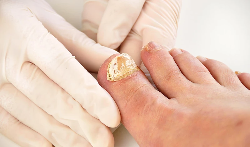 Why Healing Signs Can Be Subtle