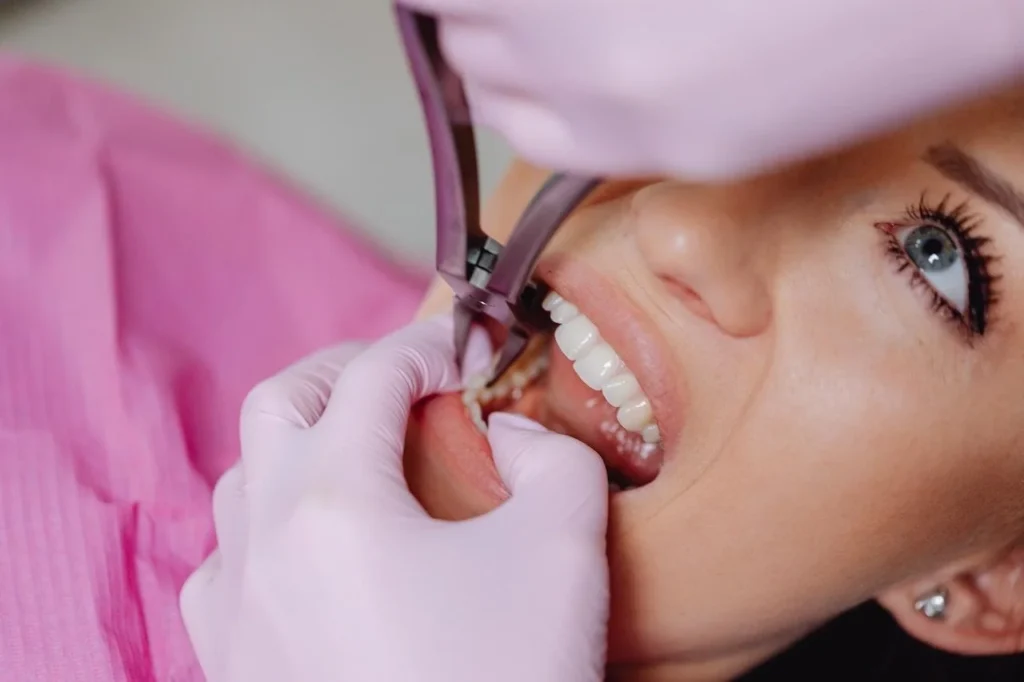 Wisdom Teeth Removal When Is It Necessary