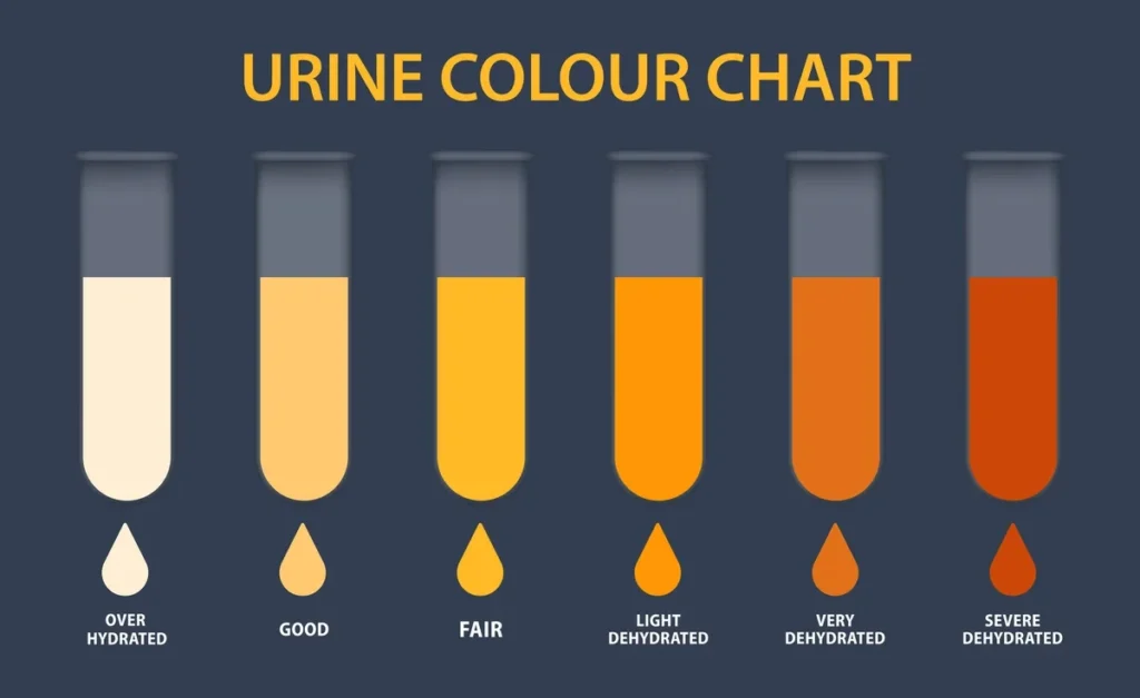 15 key Reasons for Burning Tip of Urethra No STD 6 Dehydration and Concentrated Urine