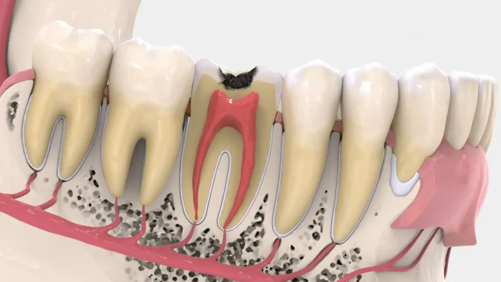 Helps Prevent Cavities