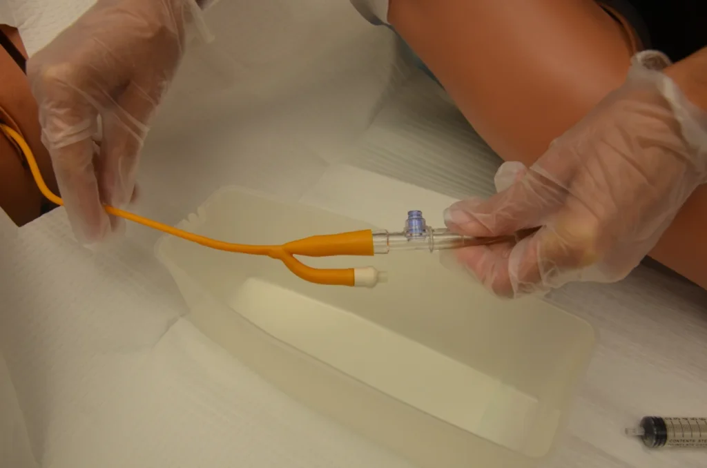 15 key Reasons for Burning Tip of Urethra No STD 9 Recent Catheter Use or Medical Procedures