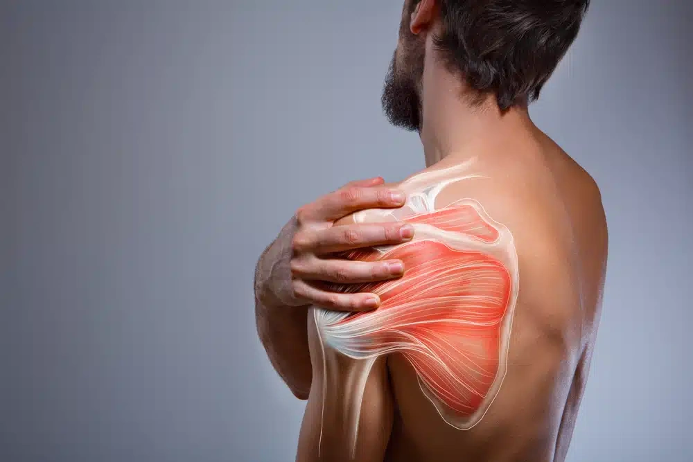 Home 3 A man with a beard holds his painful left shoulder, which shows a digital overlay highlighting the shoulder muscles and tendons on his bare back, illustrating muscle anatomy and shoulder pain.