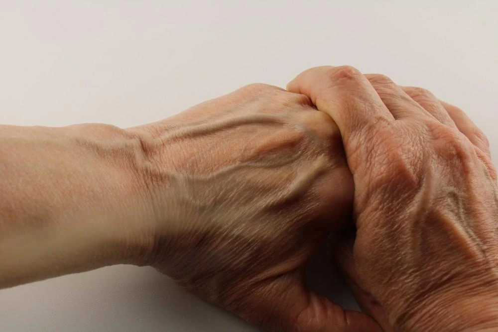 10 Causes of Sudden Bulging Veins in Hands With Pain