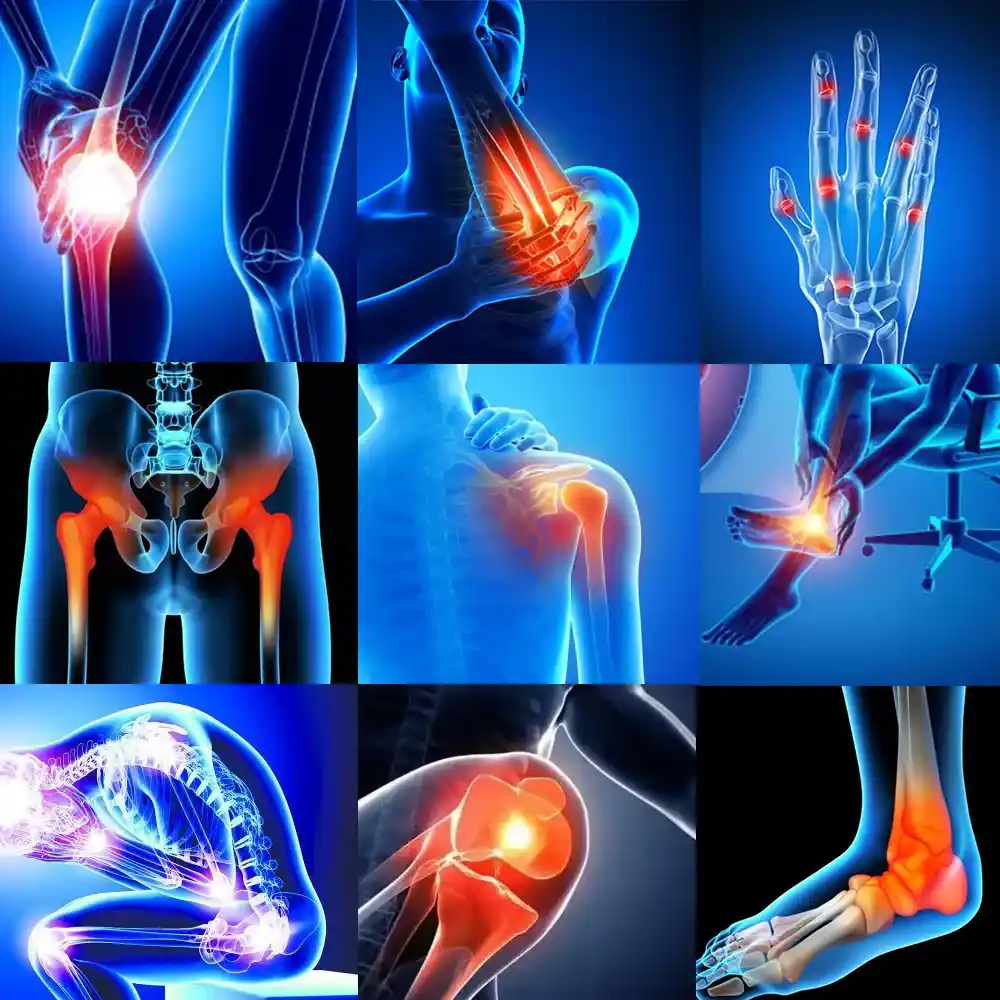 How Long Do Osteoarthritis Flare-Ups Last? 10 Causes & Treatment 5 Injury or Joint Trauma
