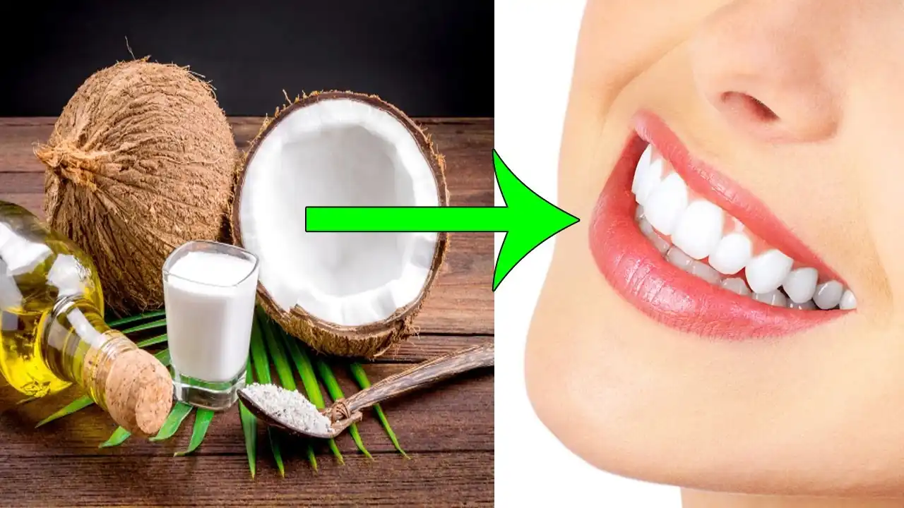 Is coconut oil good for your teeth? 10 Dental Reasons 2 A photo of coconuts, coconut oil, and coconut milk on a table with a green arrow pointing to a close-up of a smiling mouth with bright white teeth.