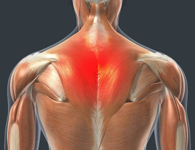 10 Causes of Pain in Upper Right Arm Between Elbow & Shoulder 4 Muscle Strain or Overuse