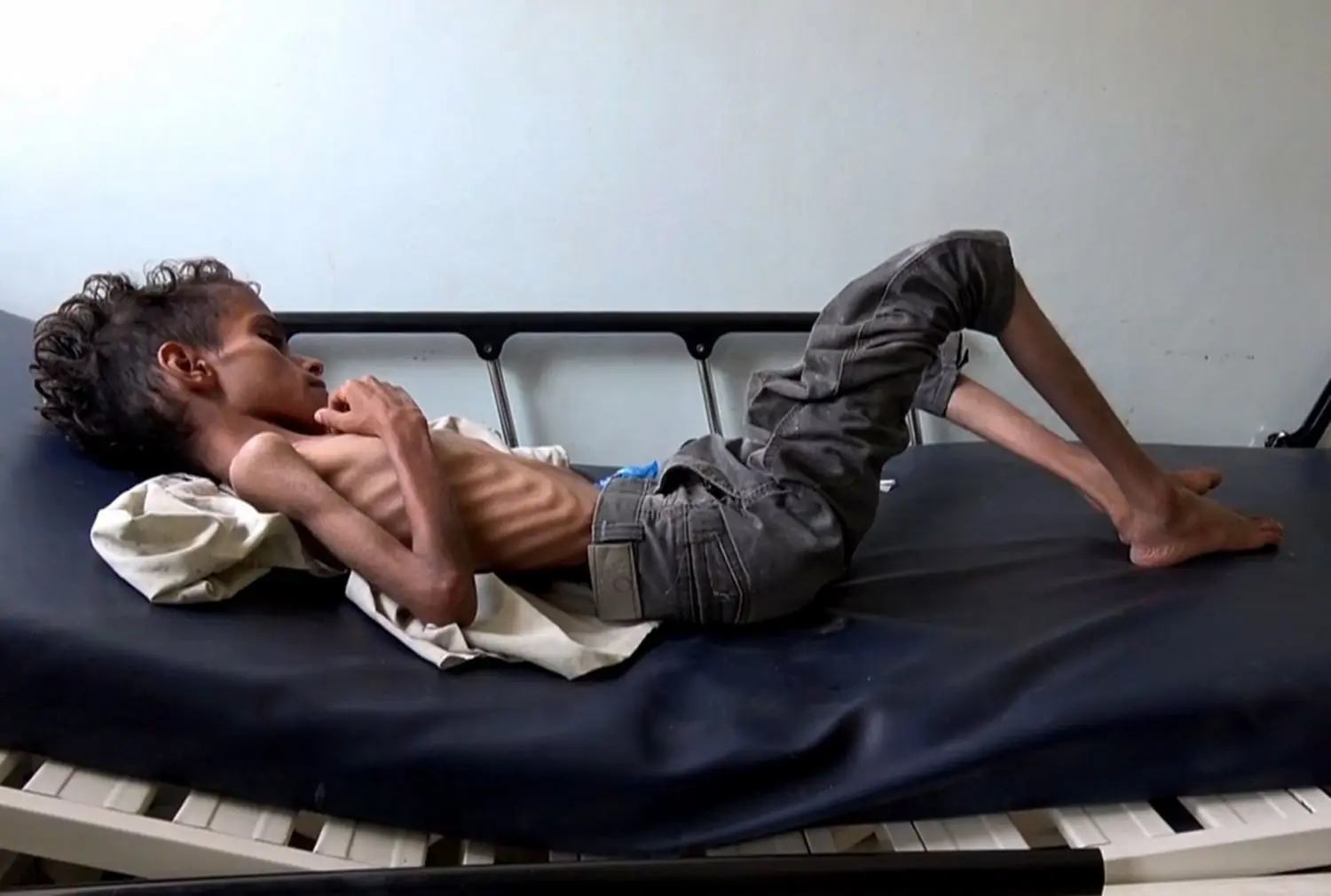 How Long Can Someone Live Without Food? 13 Key Facts 6 Organ Failure Terminal Starvation Beyond 30–60 days