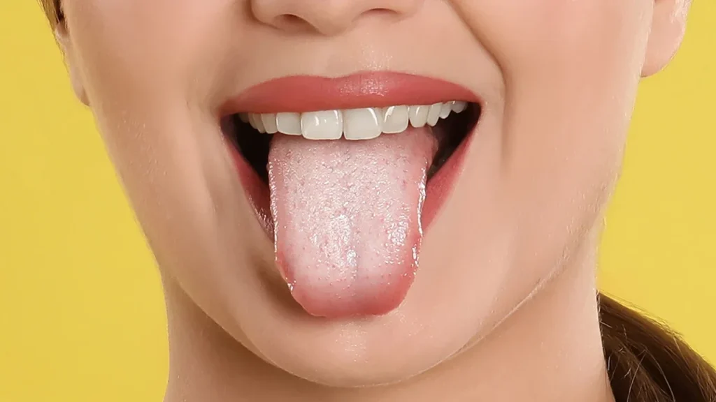 Is coconut oil good for your teeth? 10 Dental Reasons 10 Prevents Oral Thrush and Fungal Infections