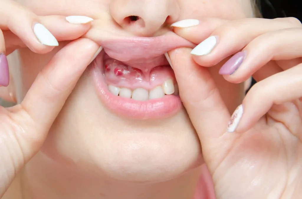 Is coconut oil good for your teeth? 10 Dental Reasons 9 Strengthens Gums and Oral Tissues