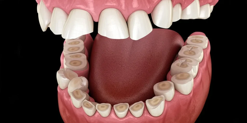 Why Does My Jaw Keep Locking? 12 Causes & Fixes 5 Teeth Grinding Bruxism