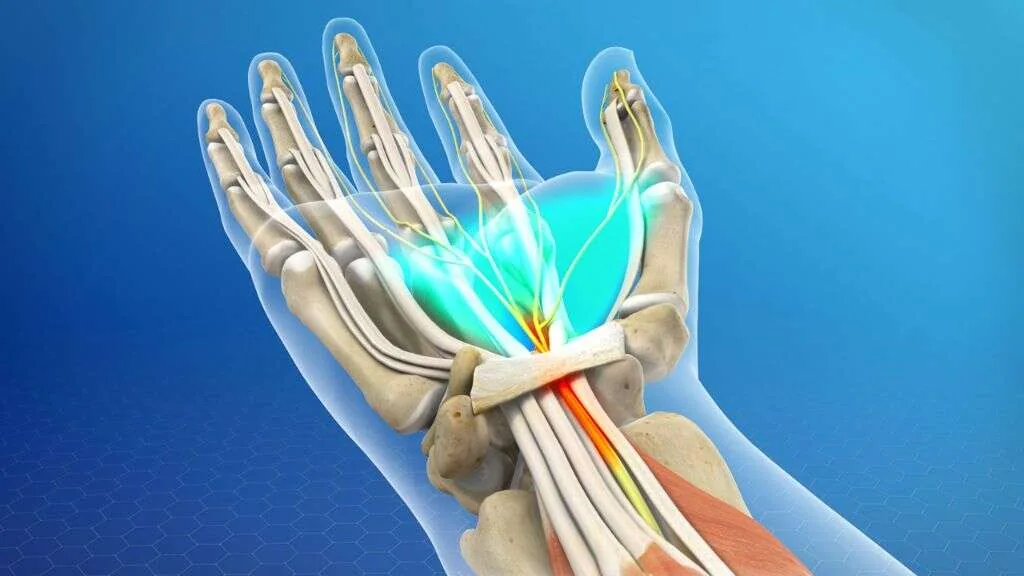 10 Causes of Pain in Upper Right Arm Between Elbow & Shoulder 13 Trapped Nerve or Tendonitis