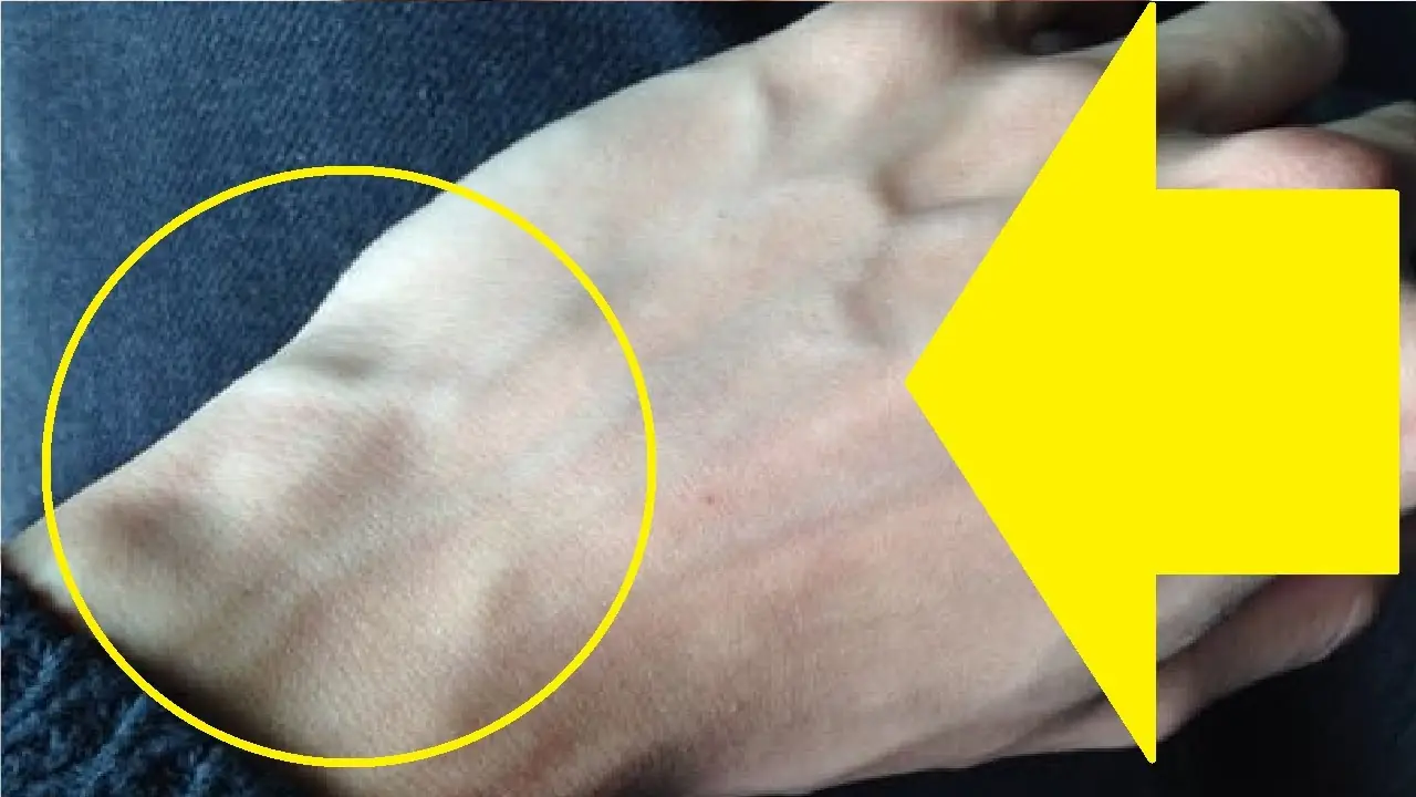 Sudden Bulging Veins in Hands With Pain: 10 causes 3 Understanding How Veins Work Your Bodys Hidden Highways