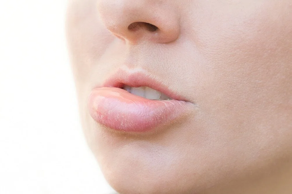 10 Fast Ways to Heal a Cold Sore Corner of Mouth 5 Use Ice or a Cold Compress to Reduce Swelling