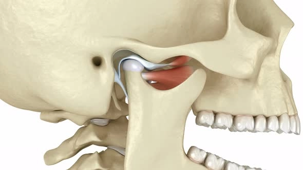 Why Does My Jaw Keep Locking? 12 Causes & Fixes 3 What Does It Mean When Your Jaw Locks
