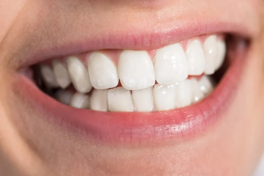 Is coconut oil good for your teeth? 10 Dental Reasons 7 Whitens Teeth Gently