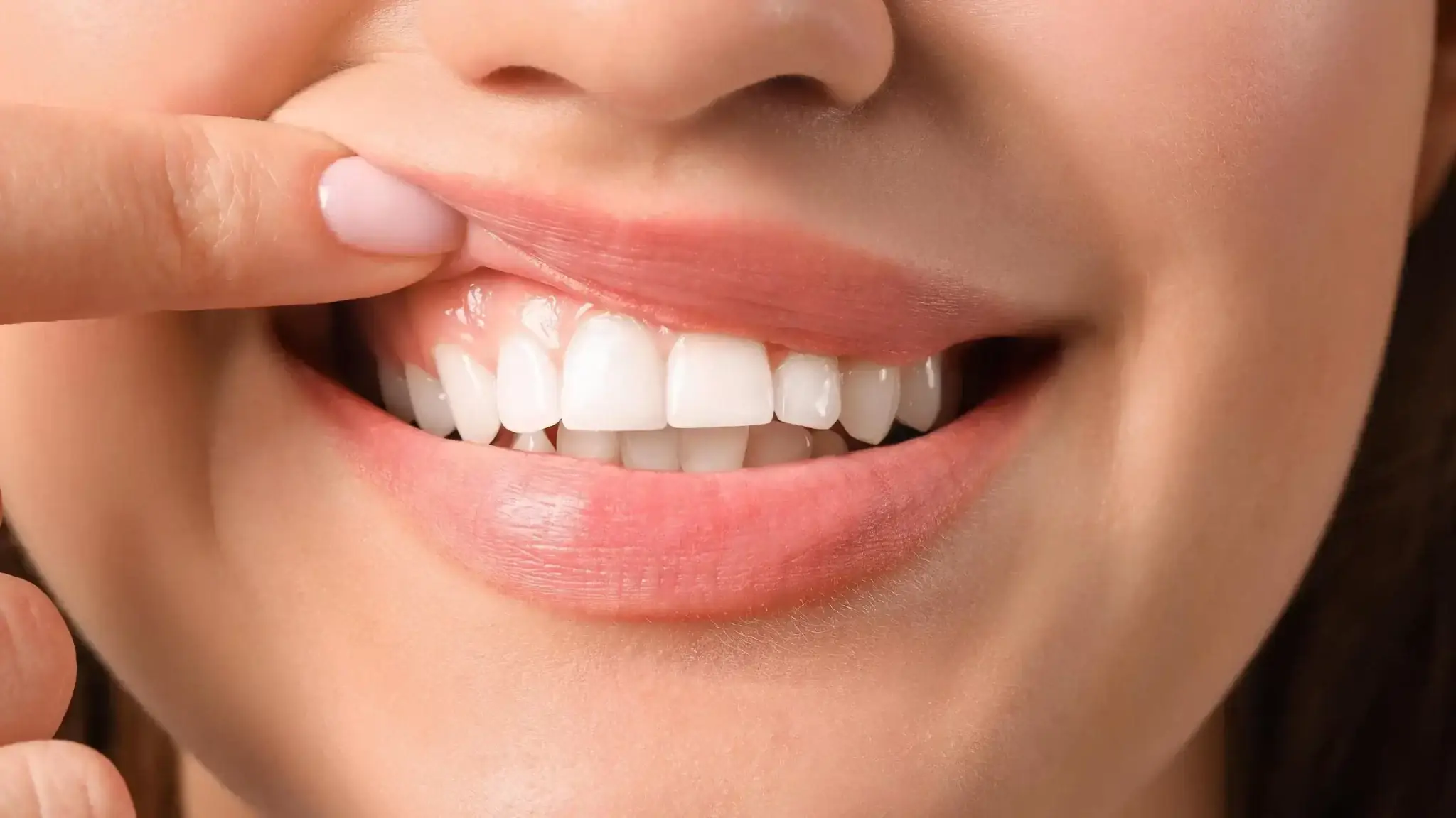 Collagen and Gum Tightening