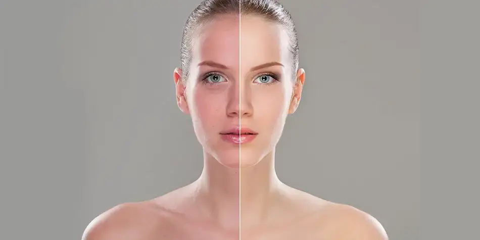 What Treatments Deliver Both Even Tone and Brighter Skin